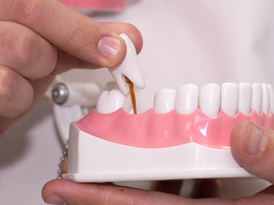 Протезирование зубов: виды искусственных зубов