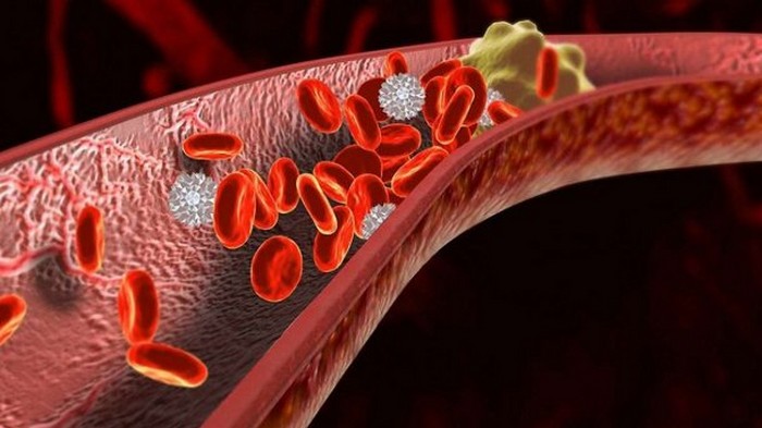 Признаки тромбов в кровеносных сосудах, и что делать, если вы их обнаружили