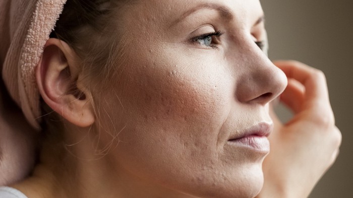 7 неприятностей, которые ждут тех, кто не смывает перед сном макияж