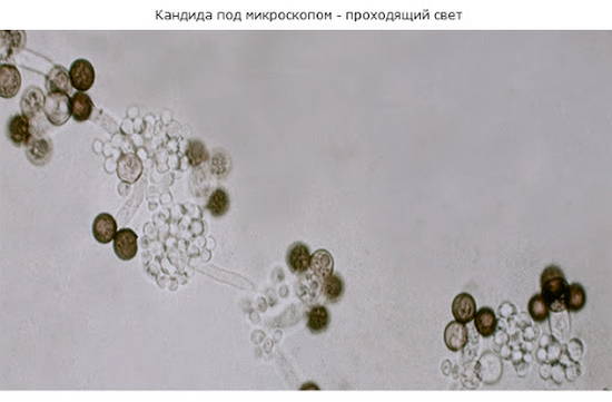 грибок Кандида под микроскопом