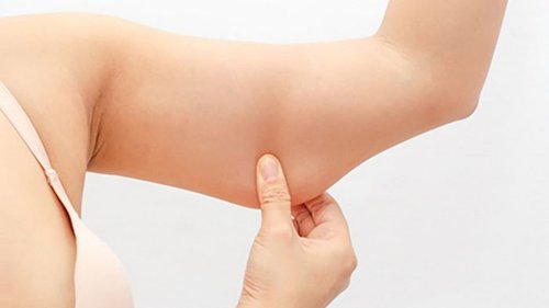 Липосакция рук: что нужно знать?