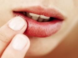 Герпес: правда и мифы о простуде на губах