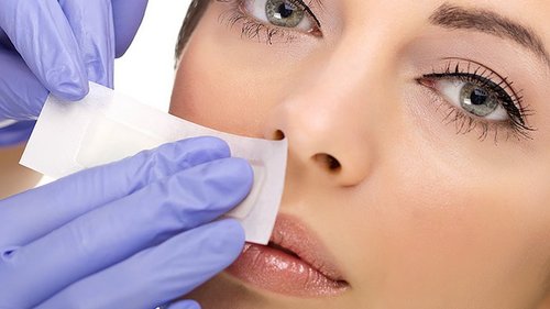 Полное руководство по удалению темных пятен на шее, локтях, коленях и в области подмышек