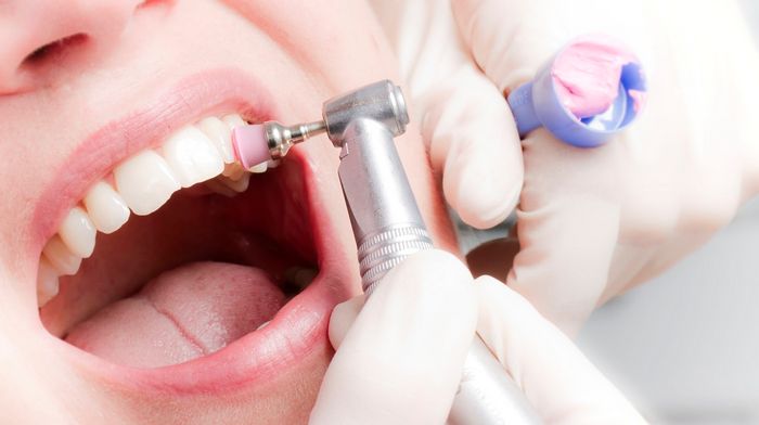 Польза и особенности профессиональной чистки зубов