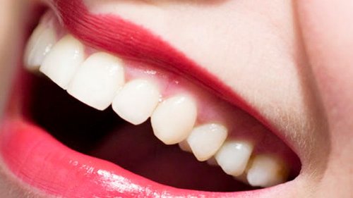 3 минуты процесса, может обеспечить ослепительные белые зубы естественным способом!