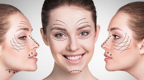 Что необходимо знать о мезонитях?