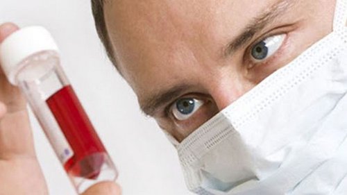 Симптомы ВИЧ — важно знать каждому!