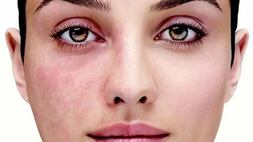 4 продукта, которые ускоряют старение организм