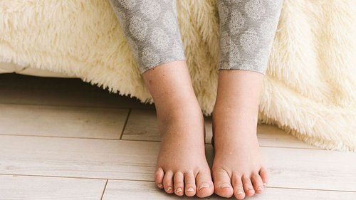 Задержка жидкости в организме: 5 сигналов