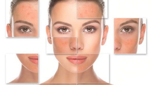 Советы по использованию салицилового пилинга лица