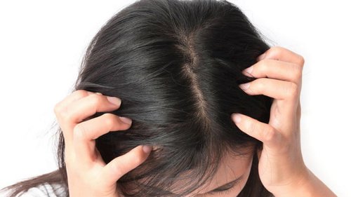 Что такое перхоть и как от нее избавиться