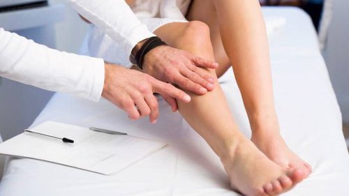 Варикоз: врачи назвали 4 категории людей в группе риска