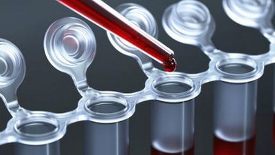 7 способов сбалансировать гормоны натуральными методами