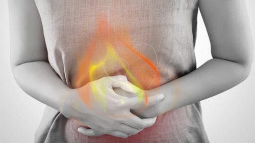 Изжога и рефлюксная болезнь