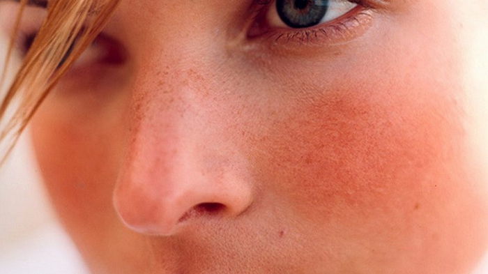 7 сигналов вашей кожи, предупреждающие о серьезных заболеваниях