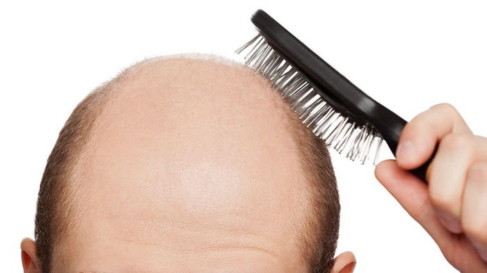 Как узнать есть ли у вас ген выпадения волос?