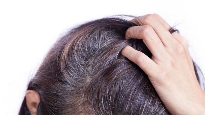 Что может привести к седине волос до 30 лет