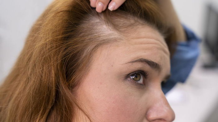 Почему после 50 лет выпадают волосы: какие есть причины и как избежать облысения