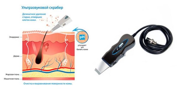 Ультразвукові скрабери та їх застосування