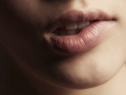 Как избавиться от «заед» на губах