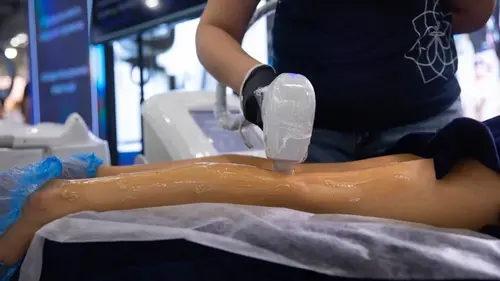 Трьоххвильовий діодний лазер та інноваційний апарат для лазерної ...