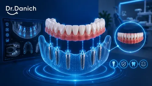 3D-модель щелепи з цифровим планом розташування імплантів