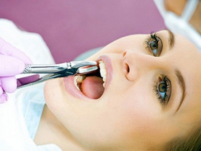 Удаление коренного зуба: что следует знать?