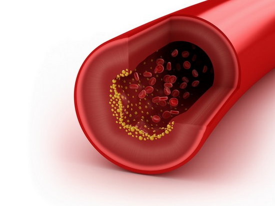 Как снизить уровень холестерина в крови без лекарств