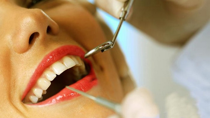 8 причин пожелтения зубов и как этого избежать